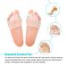 Toe Separator for Bale Toes - 2 Pairs Gel Toe Corrector & Soft Midfoot Pads for Pain Relief - Buy Online on GoSupps.com