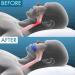Anti Snoring Mouthpiece | Sleep Apneas Mouth Guard | The Quiet Soothie Snoring Mouth Guard | Sleep Apnea Snore Stopper Mouth Guard - Buy Online on GoSupps.com