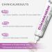 Azelaic Acid 12% Azelaic Acid For Face Serum Rich in Niacinamide and Hyaluronic Acid Fades Post Acne Marks and Calms Redness Formula for Uneven and Blemish Prone Skin Care Unflavored - Buy Online on GoSupps.com