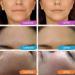 New 2024 Pure Hyaluronic Acid Serum - Hydrating & Anti-Aging Face Serum for Women | 2oz for Dry Skin & Dark Spots - Buy Online on GoSupps.com
