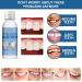 Buy Temporary Dentures & Tooth Repair Set | Instant Cosmetic Solutions for Perfect Smile - 20ML - Buy Online on GoSupps.com