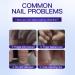 Lot de 2 s rums de soin des ongles - S rum de construction intensif - Pour hommes et femmes - Hydrate les cuticules s ches - S rum nourrissant pour ongles cass s et d color s - Buy Online on GoSupps.com