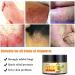 Sensitive Skin Natural Eczema Treatment Cream - Steroid & Fragrance-Free Psoriasis Relief - Anti-Itch & Moisturizing Formula - 1.06oz - Buy Online on GoSupps.com