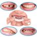 Temporary Fake Dentures Teeth for Broken, Gap & Missing Teeth - Improve Smile - Buy Online on GoSupps.com