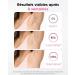  pilateurs Lumi re Puls e IPL pilateur Laser Definitive 9 Niveaux d' nergie 3 Modes pilateur Laser Hair Removal pour Aisselles/Visage/Maillot Femme Hommes-Rose - Buy Online on GoSupps.com