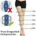 Ailaka Thigh High 20-30 mmHg Medical Compression Stockings - Medium, Beige, Open Toe - 1 Pair - Buy Online on GoSupps.com