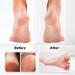 2 Pcs Glass Pumice Stone Set - Foot and Hand Callus Remover & Scrubber for Skin Exfoliation | Pedicure Exfoliator Tool for Home Pedicure - Buy Online on GoSupps.com