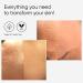  me pure CIT Face Derma Roller Basic KIT 100% Natural Microneedling Treatment for Sensitive Skin (Dermaroller 0.5mm + Gel + Disinfectant) - Buy Online on GoSupps.com