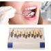 Teeth Shade Guide: 29 Colors Comparison - Removable Tooth Bleaching Whitening Chart - Buy Online on GoSupps.com