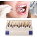 29 Color Porcelain Tooth Whitening Color Keys - Removable Tooth Elevation Table for Accurate Shade Matching - Buy Online on GoSupps.com