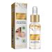 S rum pour les Yeux de la Particule Gras 30ML 1PC(Milia Remover limine les Particules de Graisse sous les Yeux) Hydratante