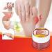 2PCS Urigone Bunion Healing Ointment - Toe Stiffness & Joint Valgus Relief Cream - Buy Online on GoSupps.com