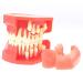 Lmeil tooth deformality-toothing-to-toothing development model milk teeth-constant pressure change model silicone material suitable for the tooth lessons of children