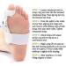 Bunion Corrector & Relief - Orthopedic Bunion Splint Pads & Hammer Toe Straightener - 1PC Bunion Protector Cushions - Buy Online on GoSupps.com