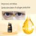 Time Eraser Rollerball with Castor Oil & Frankincense - Essential Oil Eye Treatment (1pcs) | International Shipping - Buy Online on GoSupps.com