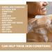 Almond Shower Gel (200ml) by Naturally Solved - Anti Fungal Body Wash for Jock Itch, Thrush, Acne & Athletes Foot - Buy Online on GoSupps.com