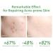 LANBENA Acne Pimple Repair Serum | Salicylic Acid Essence for Acne Prone Skin | Soothing & Calming Treatment - Buy Online on GoSupps.com