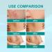2Pcs Scar Remove Advanced Spray - Remove Dark Acne, Surgical Scars & Stretch Marks - Buy Online on GoSupps.com
