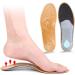 NOLITOY Flatfoot Insoles - 2 Pairs Arch Support Pads for Women | Foot Care & Xo Leg Correction - Buy Online on GoSupps.com
