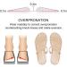 Dr. Foot Supination & Overpronation Insoles - Small Size for Kids' 1-5.5|Women's 4-7.5 - Heel Cups for Foot Alignment, Knee Pain, Bow Legs, Osteoarthritis - Medial & Lateral Support - Buy Online on GoSupps.com