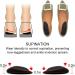 Dr. Foots Orthopedic Gel Heel Wedge Insoles - 3 Pairs for Foot Alignment, Knee Pain, Bow Legs, Osteoarthritis - Supination & Pronation Support - Buy Online on GoSupps.com