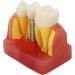 Verdant Touch Crown Bridge Demonstration Model - 4X Dental Implant Model for Doctor-Patient Education | International Shipping - Buy Online on GoSupps.com