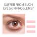 Rose Essential Oil Day and Night Eye Cream - Dark Circles & Puffiness Treatment | Moisturizing, Hydrating, Anti-Aging | Women's Skincare Gift - Buy Online on GoSupps.com