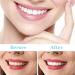 Jiazhouhb 2 Pairs Temporary Fake Teeth - Dental Veneers Artificial Dentures White Cosmetic Prostheses for International Shipping - Buy Online on GoSupps.com
