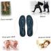 NOLITOY Magnetic Acupressure Insoles - Full Length Arch Support Reflexology Shoe Pads for Massage & Foot Comfort | International Shipping Available - Buy Online on GoSupps.com