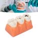 4-fold caries model for teaching tooth caries simulation and diagnostic procedures training of dentists and dentistry students portable and easy