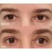 240Count x 7MM Invisible Eyelid Tapes Stickers Self-adhesive Fiber Eyelid Correcting Strips Instant Eye Lid lift No Surgery Stay 24 Hours Perfect for Hooded Drooy Uneven Eyelids - Buy Online on GoSupps.com