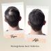 Organic Hair Growth Serum 1 oz | Scalp-Stimulating Hair Oil for Thinning & Hair Loss | Suitable for All Hair Types - Unisex Formula - Buy Online on GoSupps.com
