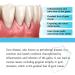 EIRZNGXQ Gum Treatment Drops 30ml - Repair & Nourish Gums | International Shipping Available - Buy Online on GoSupps.com