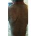 G16 Skin Repair Lotion: Effective Ichthyosis Treatment Cream for Outstanding Results in 2 Weeks - Buy Online on GoSupps.com