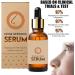 Liftx Nose Defining Serum Sci-Effect Nose Lift Shaping Oil Nose Lift Up Shaping Essence Oil Nasal Bone Remodeling Serum Remodeling Contouring Oil Serum (1 Pcs) - Buy Online on GoSupps.com