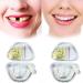 Provisional Teeth Veneers - Flipped Warm Temporary Dentures for Perfect Smile | Cosmetic Artificial Teeth - Buy Online on GoSupps.com
