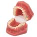 Orthodontic demonstration model for dental research - metal wires and ceramic brackets included - teaching aids for adults