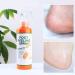 Foot Peeling Spray Natural Orange Essence Remove Foot Dead Skin Exfoliating Foot Moisturizing Hydrating Foot Peeling Spray Orange Oil for Cracked Rough Heels & Calluses - Buy Online on GoSupps.com