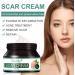 Scar Cream Silicone Scar Gel Scar Ointment Scar Cream For Old And New Scars Silicone Scar Gel Scar Cream For C-Section Burns Stretch Marks scar Removal Cream For Men&Women 50g - Buy Online on GoSupps.com