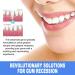 Lovilds Gum Therapy Gel - 4PCS | Effective Dental Care for Healthier Gums | International Shipping Available - Buy Online on GoSupps.com
