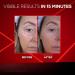 Eye Bag Firming Eraser Instant firming cream against under-eye bags retinol eye lifting serum eye cream against dark circles reduces wrinkles and fine lines (1 - Buy Online on GoSupps.com