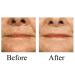 Buy Bioven Anti-Aging Venom Creams Set | Look 10 Years Younger - International Shipping Available - Buy Online on GoSupps.com