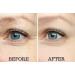 Osmotics Under Eye Rejuvenator: Best Anti Aging Cream for Dark Circles, Eye Bags, Wrinkles, and Puffy Eyes - Buy Online on GoSupps.com