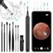 ACWOO ear wax removal Otoscope WiFi ear cleaner camera ultra-small IP67 waterproof ear endoscope ear cleaner 5040p wireless HD photo with 6 LED light for iPhone iPad & Android