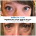 PEAK 10 SKIN iMEND Instant Eye Lift - Tightening Results - 1/2 oz - Buy Online on GoSupps.com