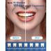 MySmile Teeth Whitening Kit with LED Light - Fast Non-Sensitive Whitener with 3 Carbamide Peroxide Gels - Remove Stains from Coffee, Smoking, Wine & Food - 10 Min Treatment - Buy Online on GoSupps.com