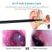 RMENST Ear Wax Removal Kit with HD Endoscope Camera - Earwax Removal Tool for Adults & Kids - Buy Online on GoSupps.com
