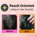 Buy Arnica - Jaborandi Hair Growth Oil | Strong & Shiny Hair | International Shipping Available - Buy Online on GoSupps.com