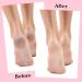 3 Pairs Silicone Moisturizing Socks for Women Silicone Socks for Dry Cracked Feet Women Happy Feet Socks for Women Anti Slip Aloe Moisturizing Socks for Dry Cracked Feet Foot Care for Women - Buy Online on GoSupps.com