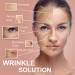 Akissos Forehead Wrinkle Patches - Face Taping for Wrinkles & Double Chin Reduction - Skin Lifting & Smoothing Strips - 2.5cm x 5m - Shop Internationally - Buy Online on GoSupps.com